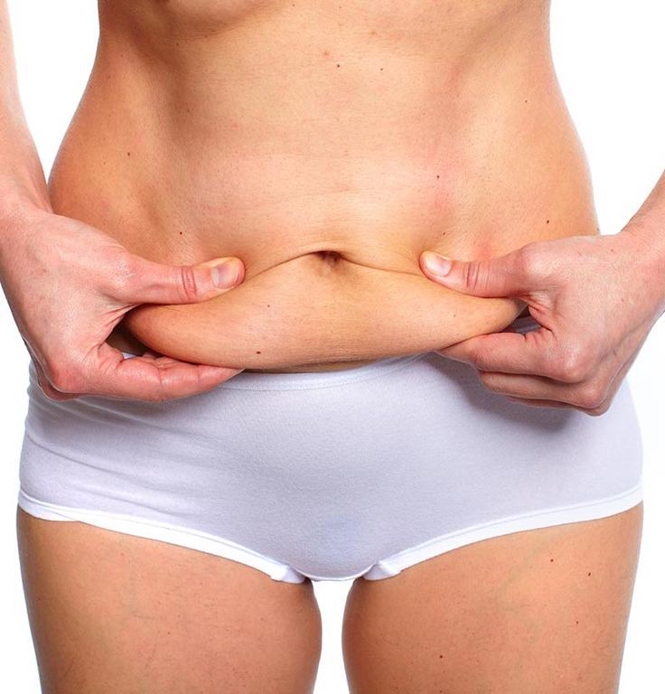 Tummy Tuck service image